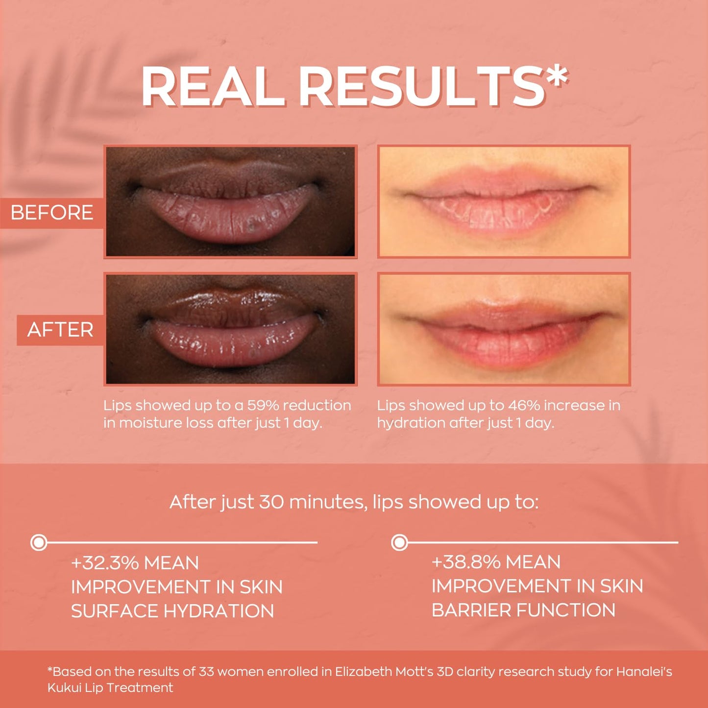 Hanalei Hydrating Lip Treatment Balm - Cruelty-Free, Paraben-Free Moisturizer for Severely Dry, Chapped Lips - Kukui Oil, Shea Butter & Grapeseed Oil Beauty & Personal Care Hanalei
