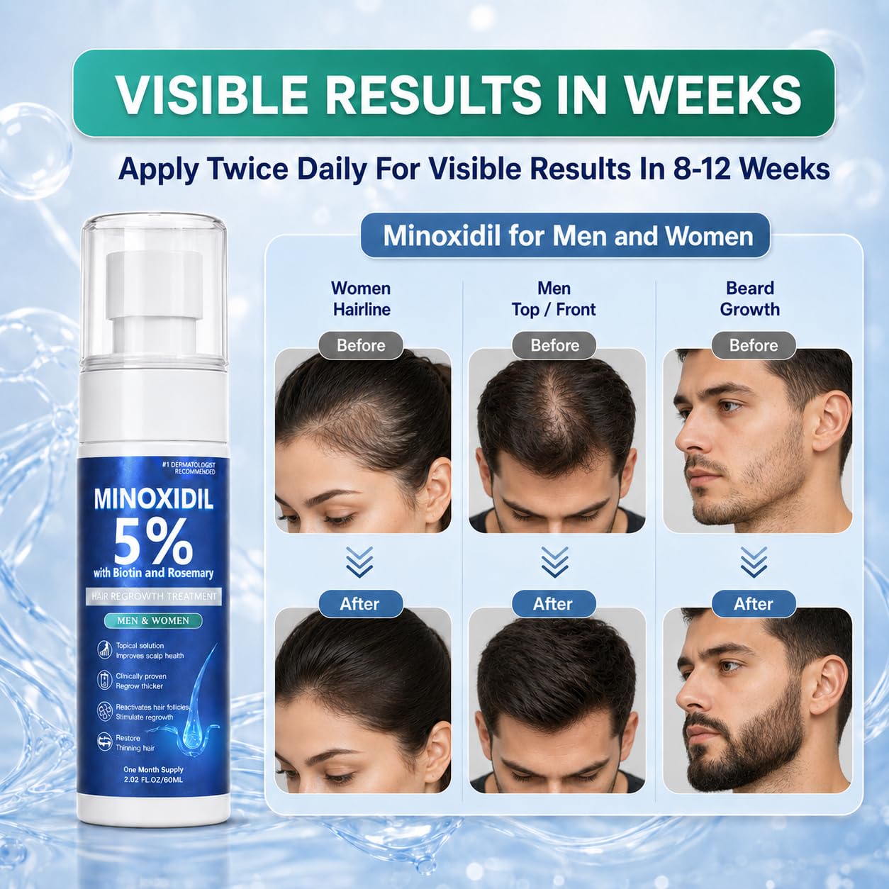Minoxidil for Men and Women, Hair Growth Serum with Biotin, Rosemary and Batana for Hair Beard Regrowth Treatments Extra Strength Hair Loss Solution Beauty and Personal Care Rylx