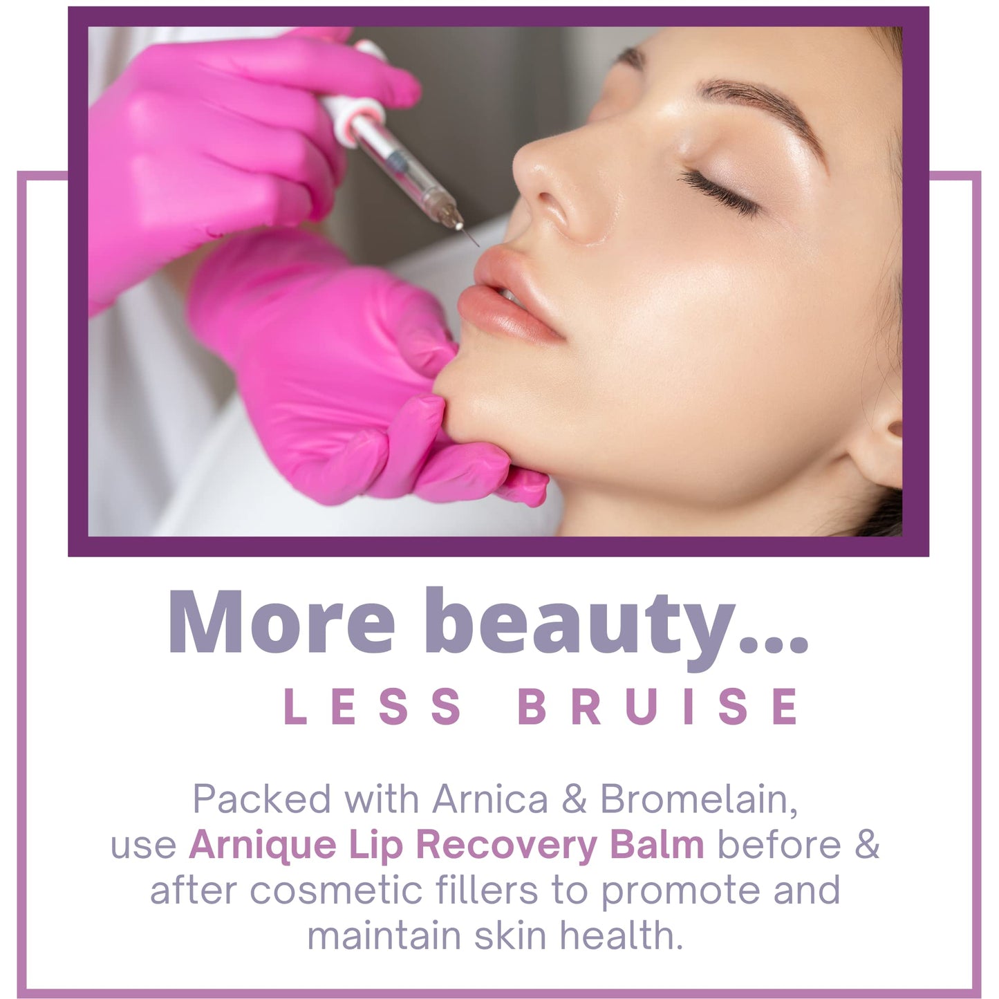 Arnique Arnica Lip Balm - Lip Filler Aftercare Balm with Arnica Montana and Bromelain, Soothing Topical Masque for Lip Flip, Injections, and Cosmetic Beauty & Personal Care Arnique
