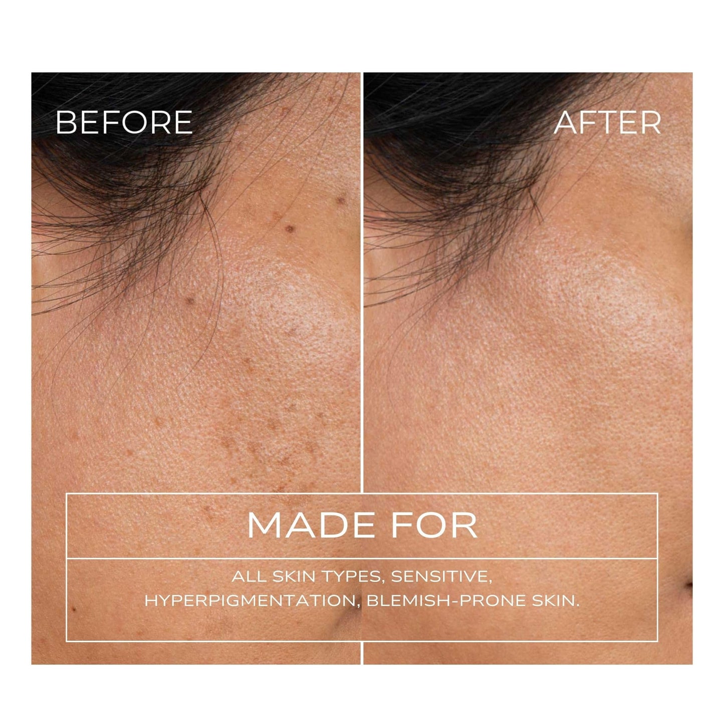 Fitglow Beauty Clear + Bright Mandelic Serum Drops | Gentle Exfoliating Face Serum | Evens Tone, Corrects Discoloration & Clears Breakouts | Beauty & Personal Care FITGLOW