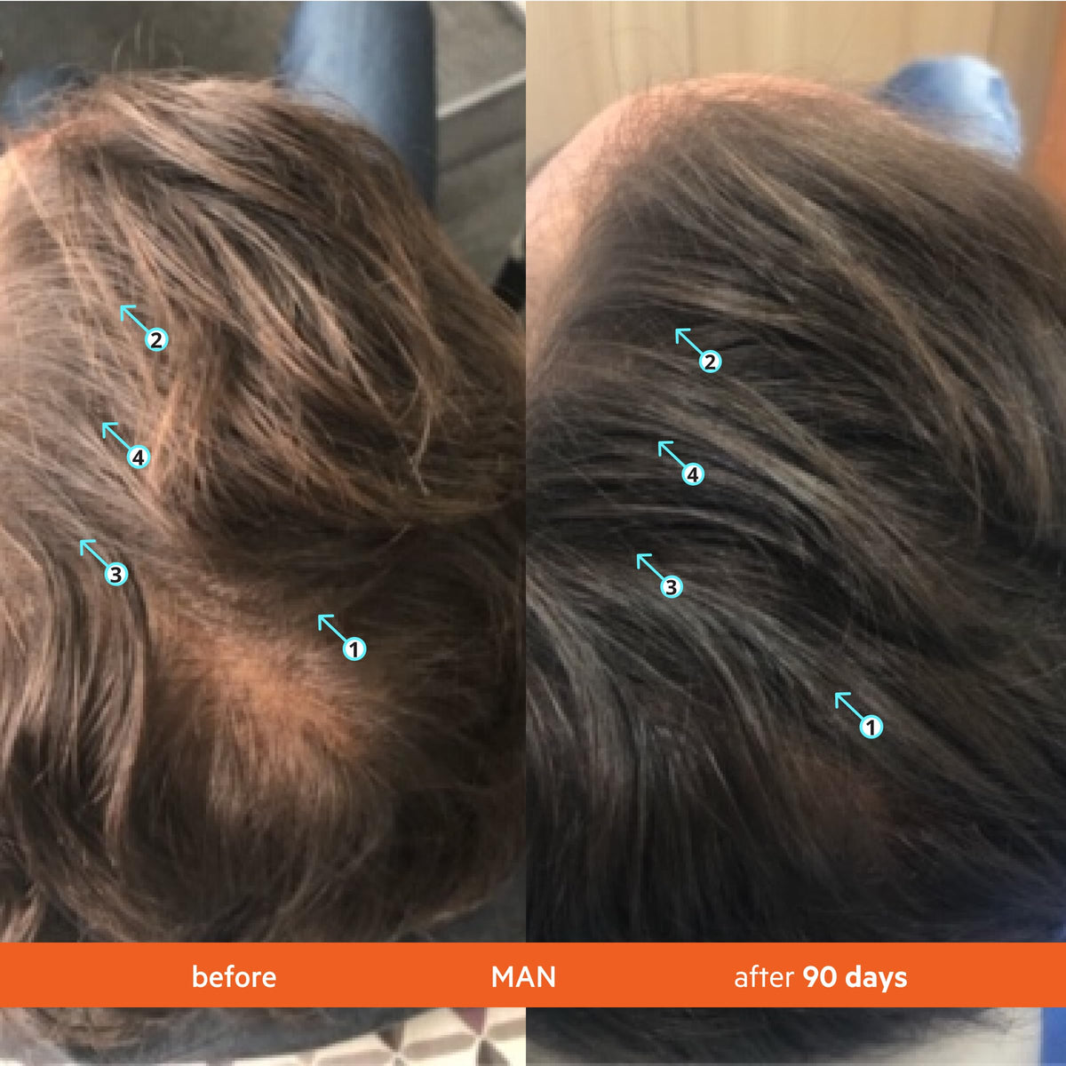 DS Labs For Men & Women Revita Shampoo & Conditioner Kit - Two-Step Scalp Care System for Fuller-Looking, Volumized Hair, Lightweight Hydration Beauty & Personal Care DS Laboratories