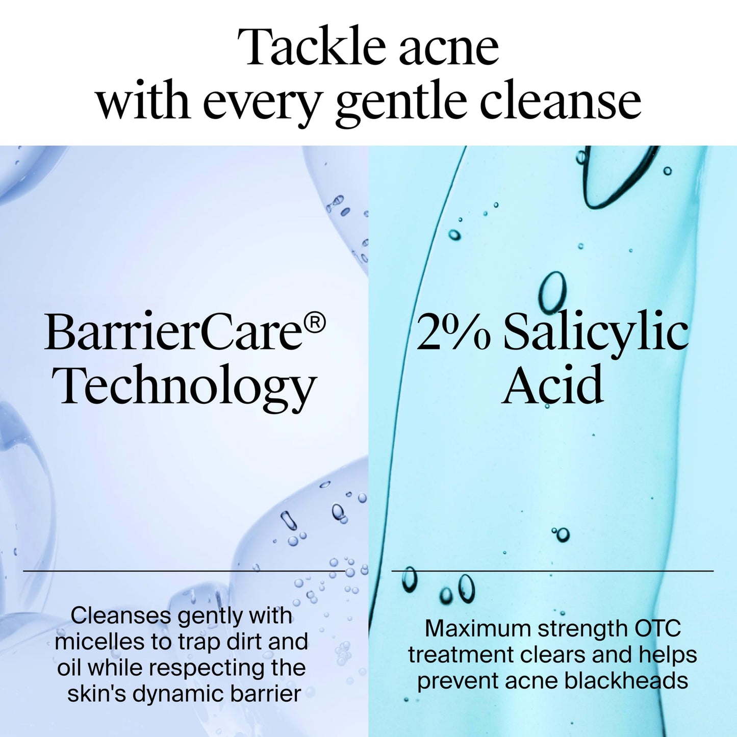 Neutrogena Oil-Free Acne Face Wash, Fragrance Free, Sensitive Skin Facial Cleanser with 2% Salicylic Acid Acne Treatment for Face, 9.1 Fl Oz Beauty and Personal Care Neutrogena