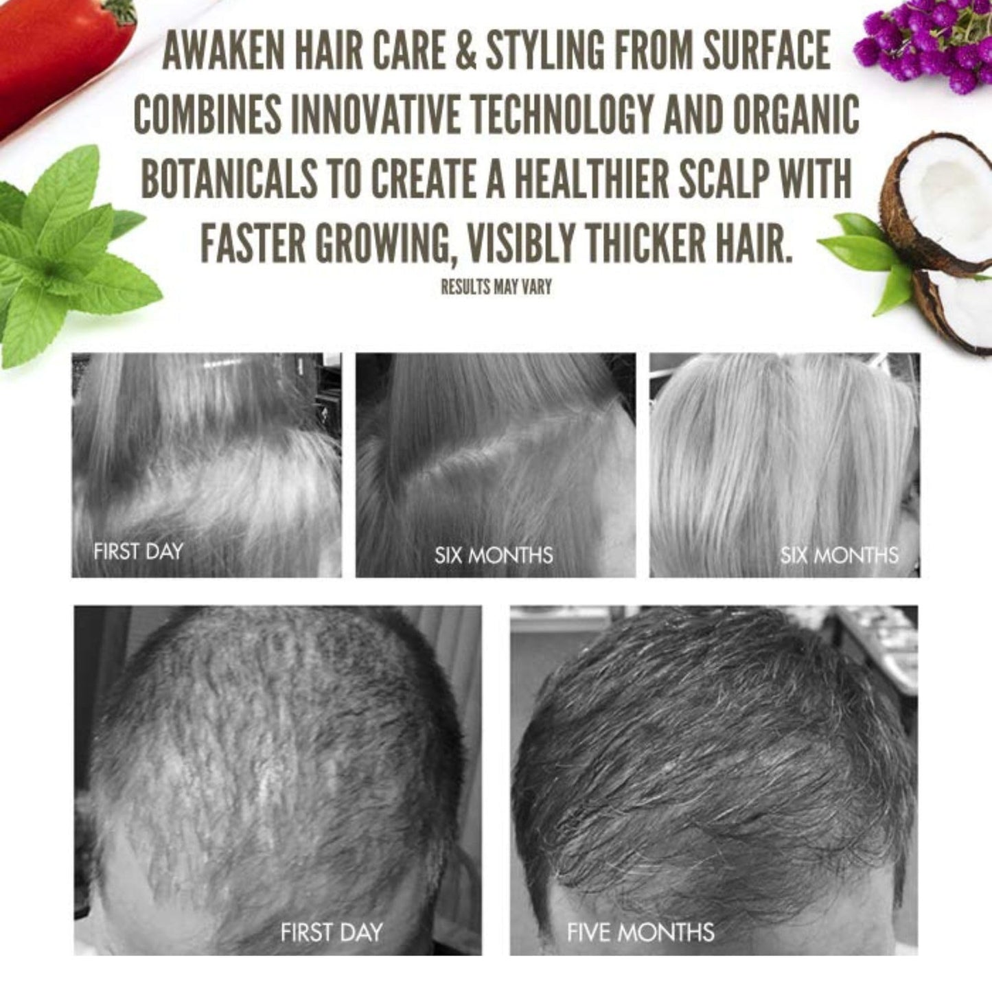 SURFACE Hair Awaken Therapeutic Masque, Scalp And Hair Rejuvenating Mask for Thinning Hair, 6 Oz. Beauty & Personal Care SURFACE