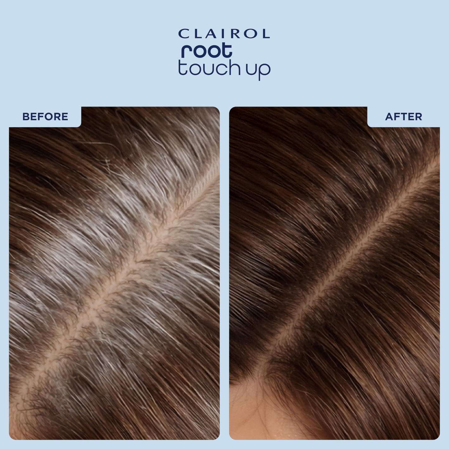 Clairol Root Touch-Up Temporary Concealing Powder, Medium Brown Hair Color | Ammonia Free | Instantly Cover Roots + Define Eyebrows | On-the-Go Beauty & Personal Care Clairol