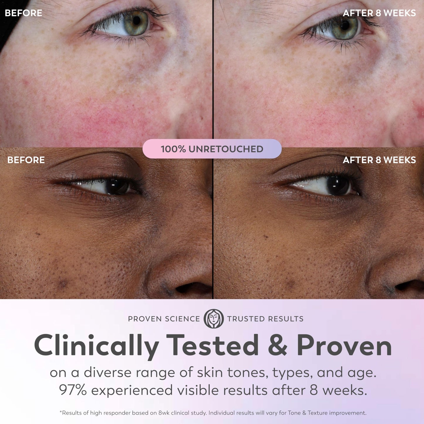 Olay Super Serum Trial Size - Niacinamide, Vitamin C & E, Collagen Peptide, AHA - 5-in-1 Skin Care Benefits - Healthy Glow, Brightening, Hydrating Beauty & Personal Care Olay