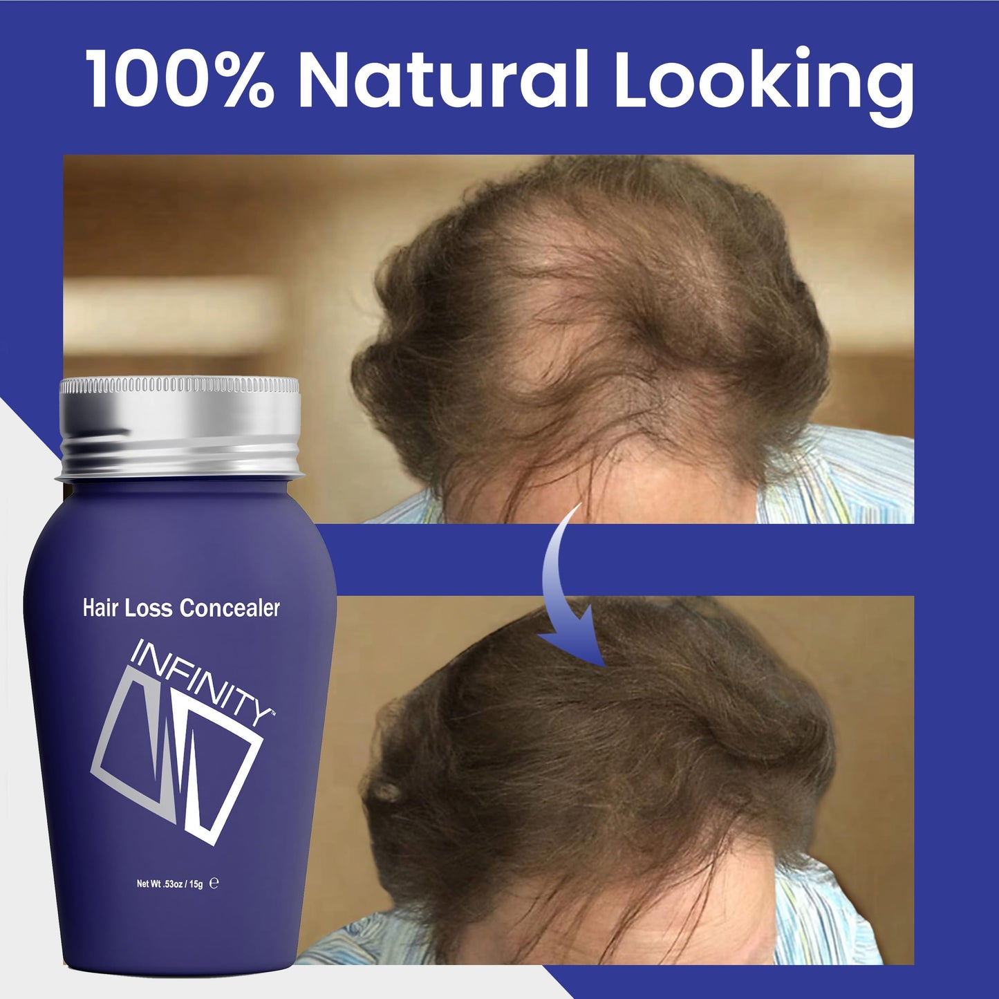 INFINITY Hair Fibers Medium Brown for Thinning Hair for Women & Men - 100% Undetectable Hair Building Fiber Powder - Conceal Hair Loss in 15 Seconds Beauty & Personal Care Infinity