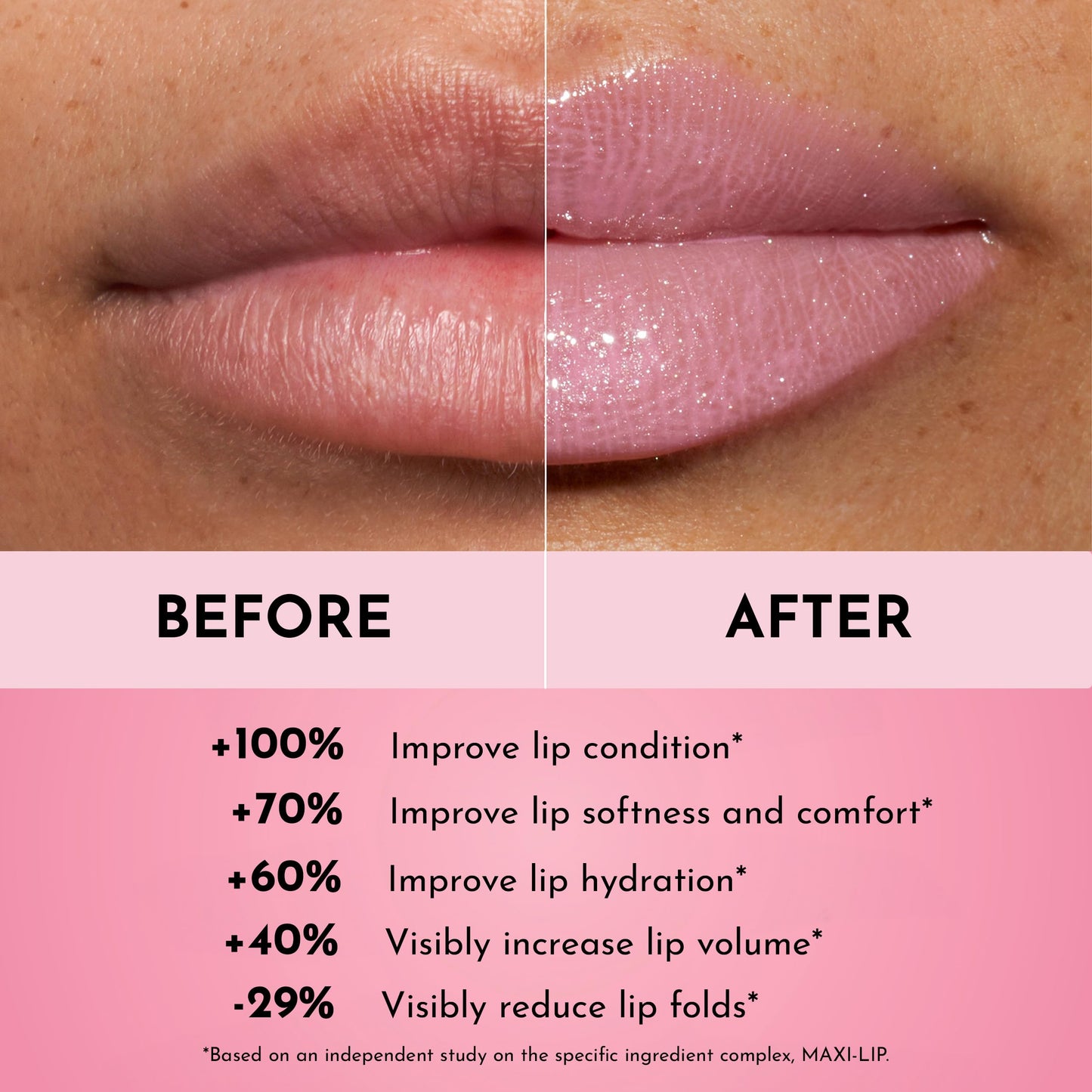 Lawless Forget the Filler Lip Plumping Line Smoothing Gloss - Daisy Girl - Premium Volumizing Lip Gloss with Natural Ingredients Designed to Plump Beauty & Personal Care LAWLESS