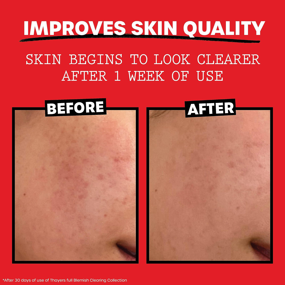 THAYERS Witch Hazel Blemish Cleanser, 4 Ounce Beauty & Personal Care THAYERS