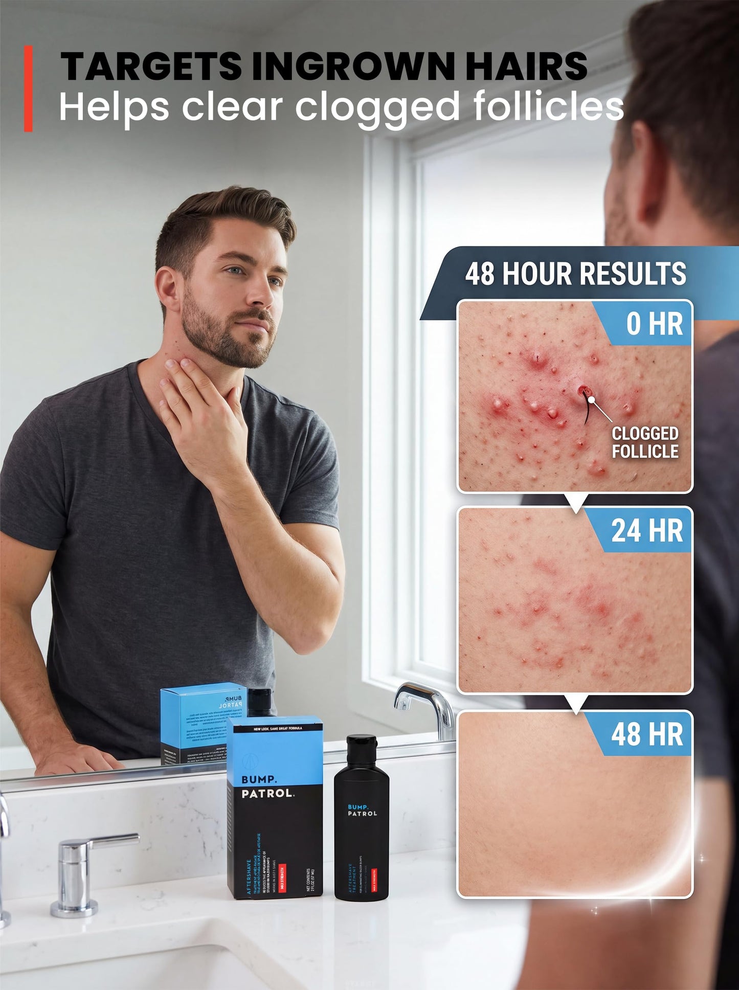 Bump Patrol Maximum Strength Aftershave Treatment Serum - Razor Bump Stopper and Ingrown Hair Treatment for Men and Women, Fast Acting Salicylic Acid Beauty and Personal Care Bump Patrol