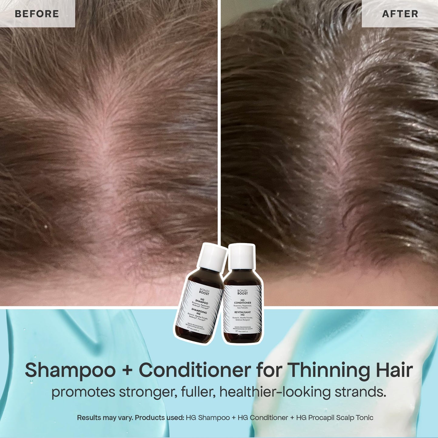 BondiBoost Shed Happens Anti-Thinning Hair Trio - HG Shampoo + Conditioner (90ML) + Lock Drops Serum (30ML) - Reduces Shedding, Supports Fuller Beauty & Personal Care BONDIBOOST