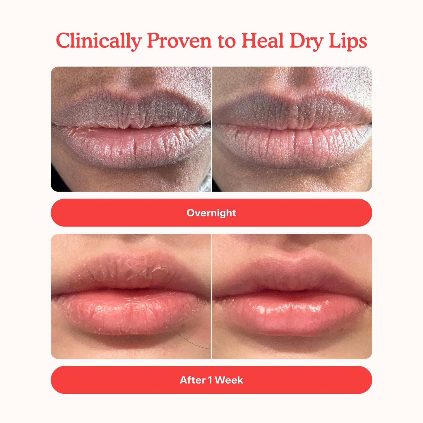 Tower 28 LipSoftie Tinted Lip Balm Treatment - Hydrating Glossy Balm + Overnight Lip Mask with Jojoba Oil + Shea Butter - Sweet, Cushiony Formula Beauty & Personal Care Tower 28