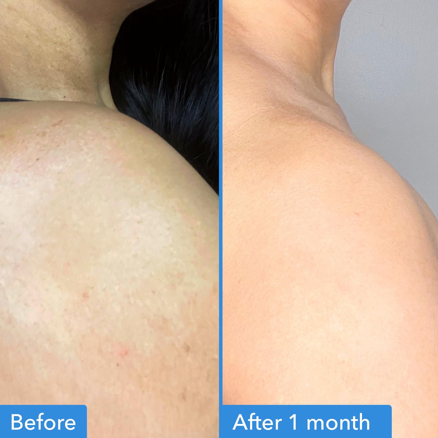 Good Molecules Discoloration Correcting Body Treatment - Anti-Pigment Cream with Niacinamide, Tranexamic Acid - Target Dark Spots and Moisturize Beauty & Personal Care Good Molecules