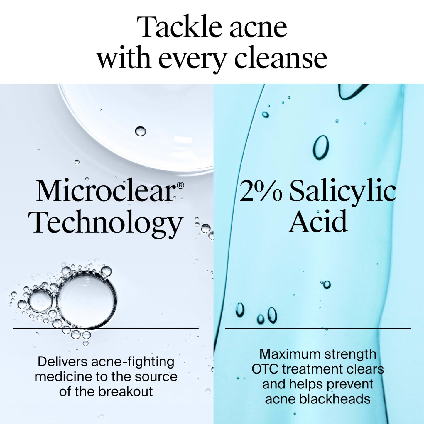 Neutrogena Acne Stress Control Triple-Action Toner 8 oz – Oil-Free Face Toner with 2% Salicylic Acid, Green Tea & Cucumber for Acne Care Beauty & Personal Care Neutrogena
