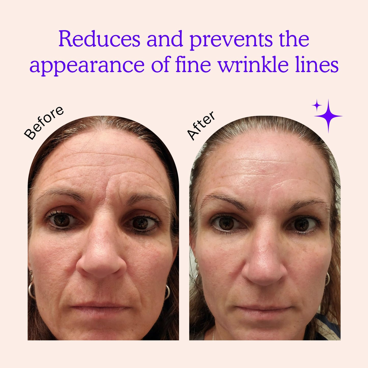 BLUMBODY Face, Forehead Wrinkle Patches - Anti Wrinkle Facial Patches to Smooth Eye, Mouth, Forehead Wrinkles - Non-Silicone Face Tape for Fine Beauty & Personal Care BLUMBODY