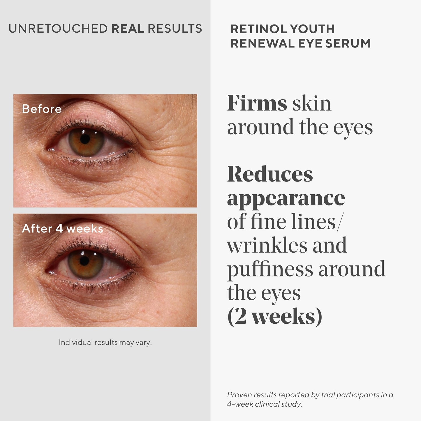 Murad Retinol Youth Renewal Eye Serum - Retinol Eye Serum Visibly Improves Undereye Puffiness Dark Circles and Reduces the Appearance of Fine Lines Beauty & Personal Care Murad