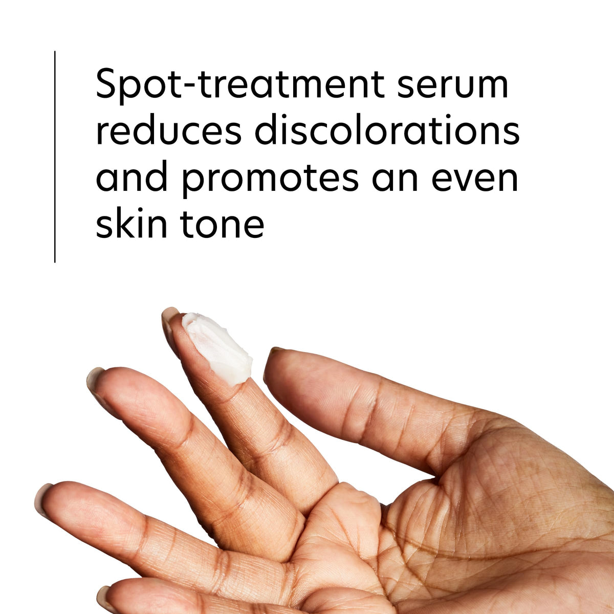 PCA SKIN Pigment Gel HQ Free Dark Spot Corrector, Hydroquinone-Free, 1 oz