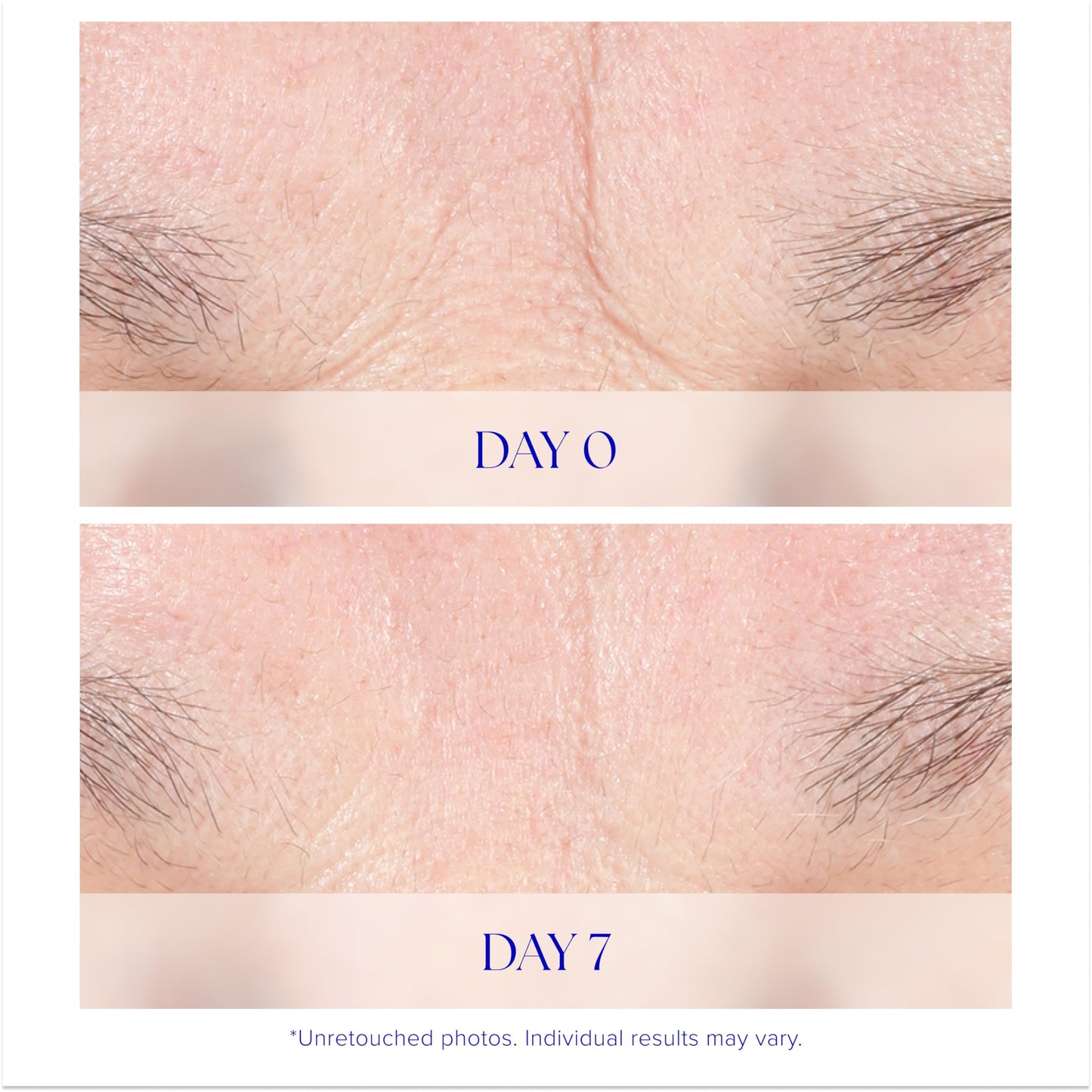 iS CLINICAL Youth Intensive Crème. Anti-aging, firming face cream. Reduces appearance of fine fines and wrinkles Beauty & Personal Care iS CLINICAL