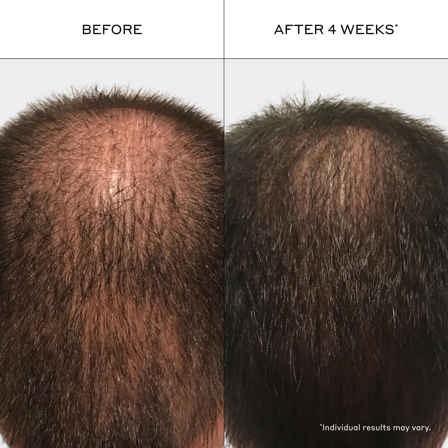 Zenagen Revolve Thickening Shampoo & Conditioner Bundle for Men (6.75 oz Each) - For Fine & Thinning Hair, Supports Fuller, Thicker-Looking Hair Beauty & Personal Care Zenagen