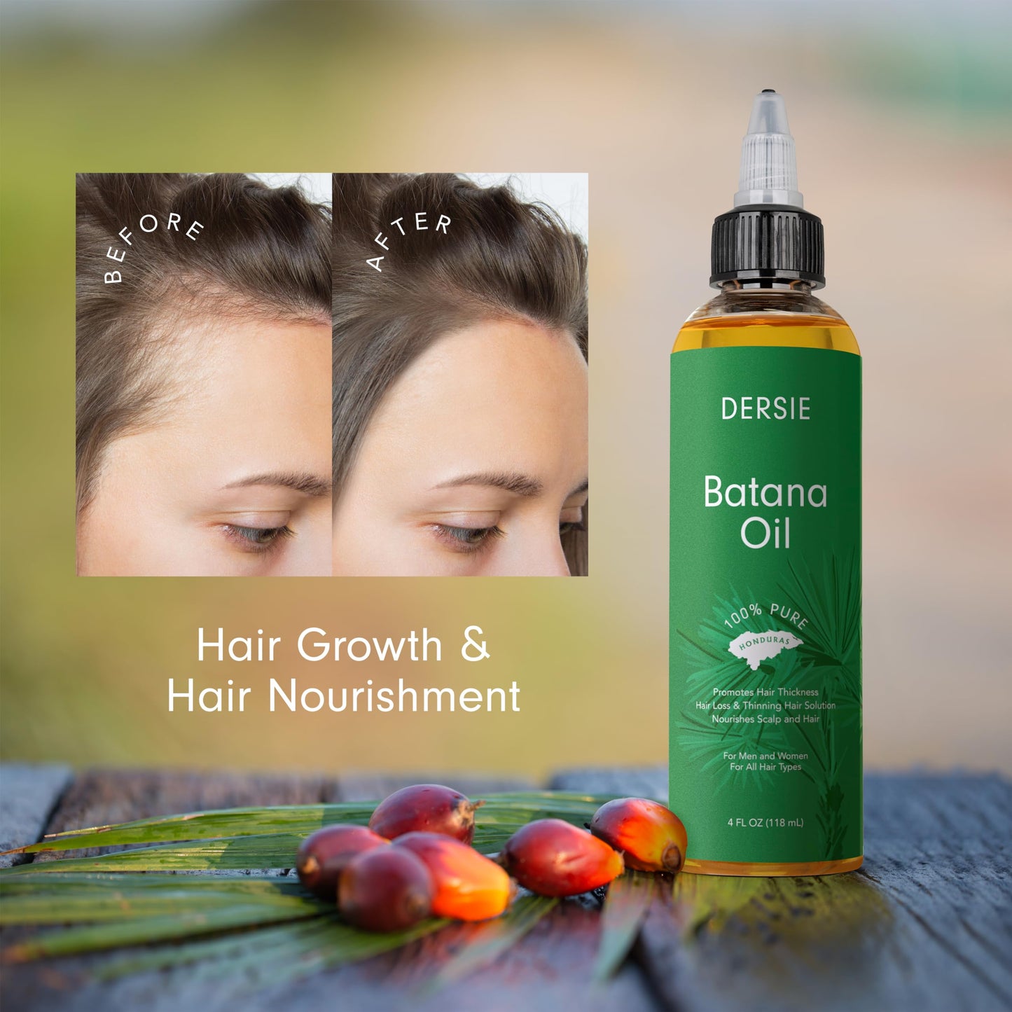 Dersie Batana Oil for Hair Growth: Dr Sebi Organic Raw Batana Oil from Honduras - 100% Pure & Natural - For Thicker & Stronger Hair - 4 FL OZ Beauty & Personal Care Dersie