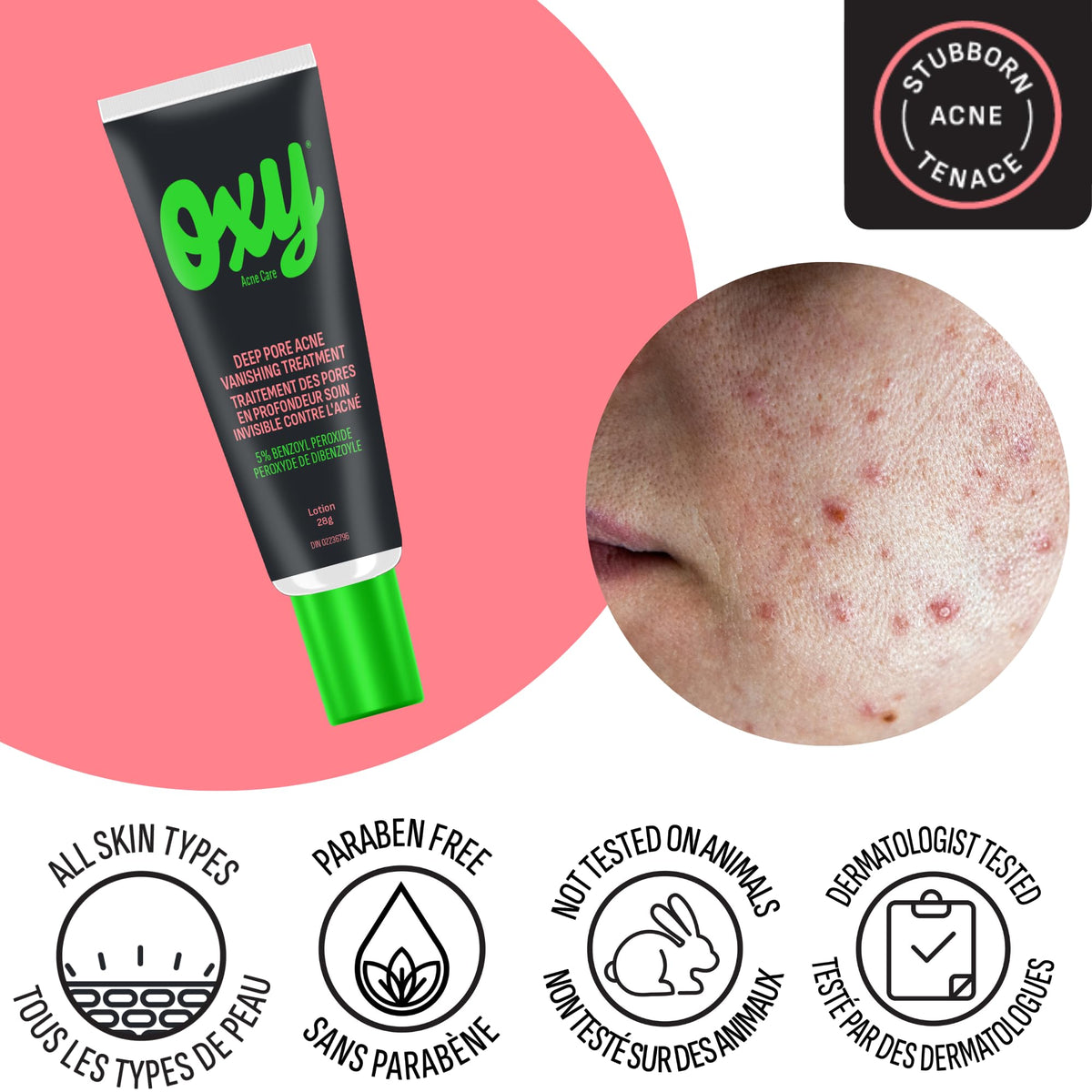 Oxy Acne Vanishing Treatment 0.10-Inches Beauty & Personal Care Oxy