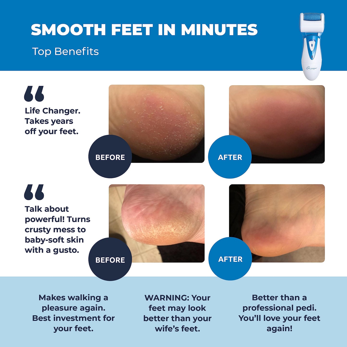 Electric Callus Remover: Own Harmony Professional Pedicure Tools Foot Care for Women, Rechargeable Foot Scrubber, CR900 Electronic Feet File Pedi Beauty & Personal Care Own Harmony