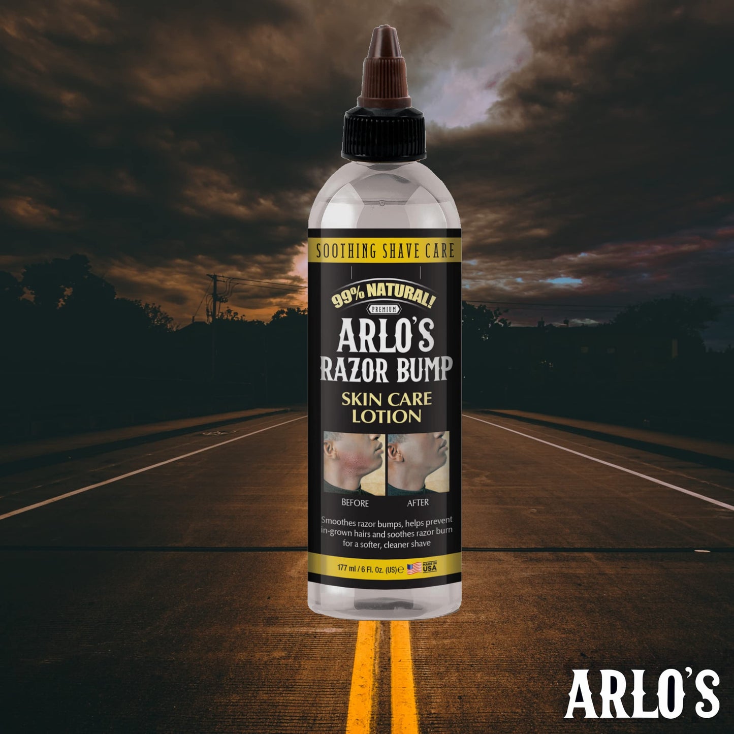 Arlo's Razor Bump Skin Care Lotion 6 oz. Beauty & Personal Care Arlo's