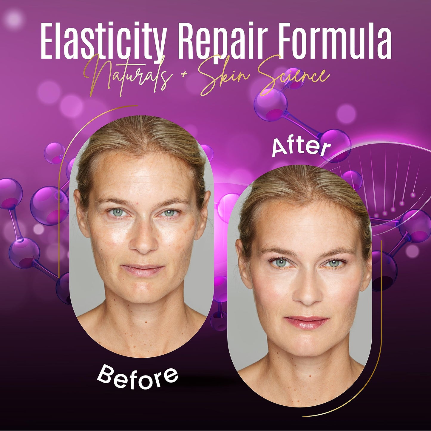 DERMAXGEN Elasticity Repair Serum, MATRIXYL 3000 - PURE ORGANIC Powerful Triple Combination Serum/Anti-Aging, Facial AGED Wrinkles Serum (1 FL OZ) Beauty & Personal Care DERMAXGEN