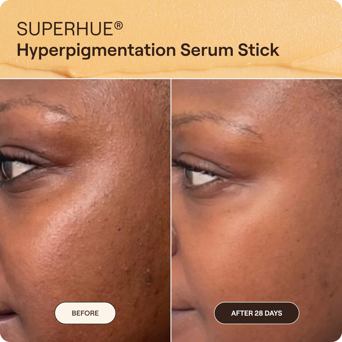 Live Tinted Superhue Hyperpigmentation Serum Stick Mini - Balm-to-Serum Stick For Face & Body - Skin Care with Niacinamide & Vitamin C, Facial Serum Beauty & Personal Care Live Tinted