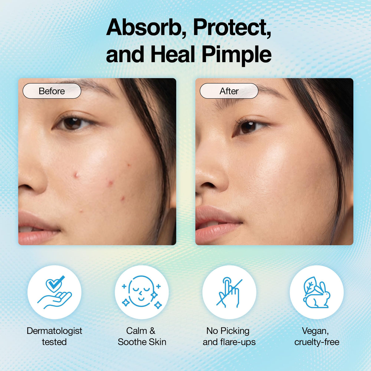 FreeGo WOO JU (??) Hydrocolloid Pimple Patch 120 Counts | Cute Colorful Star Shape | Salicylic Acid, Niacinamide, CICA, Tea Tree | Made in Korea Beauty & Personal Care FreeGo