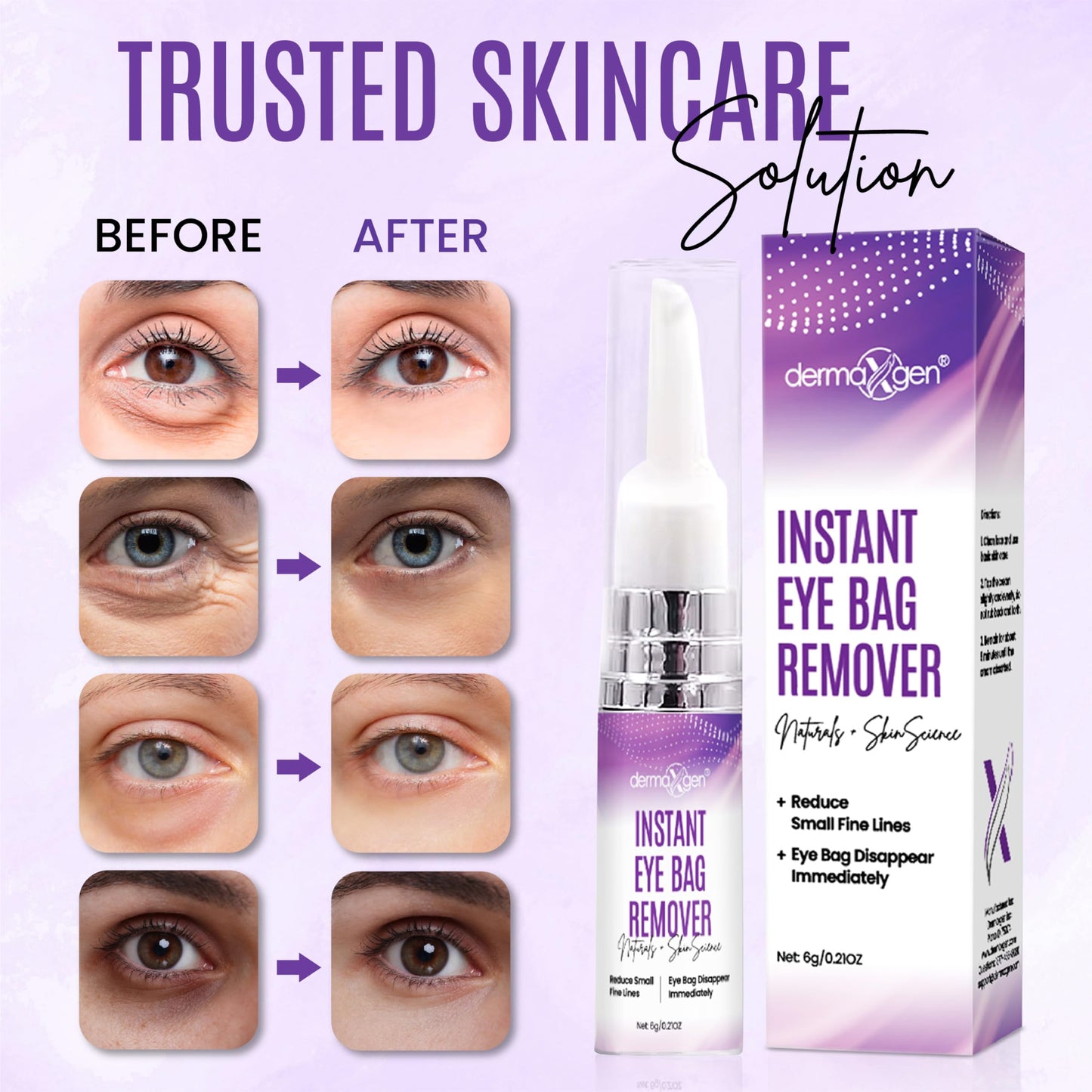 Dermaxgen Instant Under Eye Bag Remover Cream - Dark Circles Under Eye Treatment Cream for Wrinkles & Puffiness - Advanced Anti-Aging Formula Beauty & Personal Care DERMAXGEN