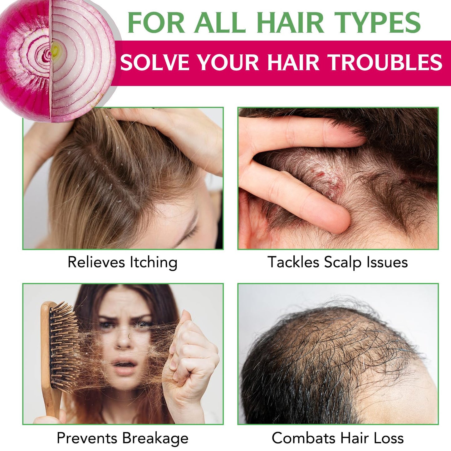 FSLHCY Onion Biotin and Rosemary Shampoo and Treatment Set, All Hair Types Conditioner Hair Care, Thinning Hair, Reduce Hair Loss -Soft and Shine Beauty & Personal Care FSLHCY