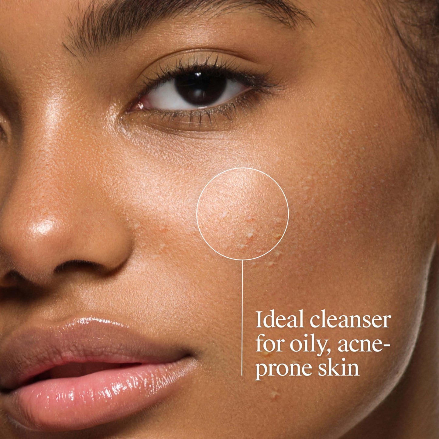 Neutrogena Oil-Free Acne Face Wash - Facial Cleanser with Salicylic Acid, Daily Cleanser for Oily & Acne-Prone Skin, Clears & Helps Prevent Breakouts Beauty & Personal Care Neutrogena