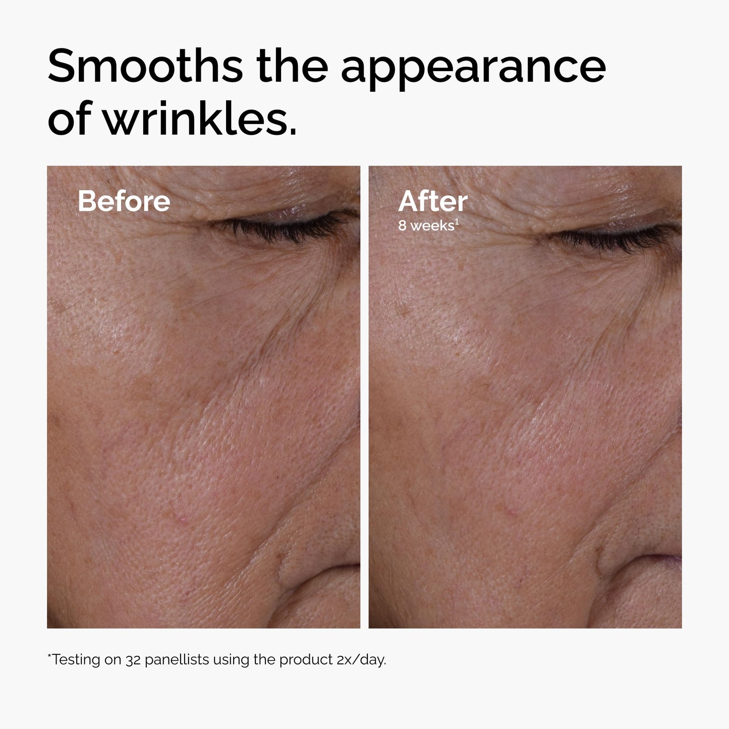 The Ordinary Multi-Peptide + Hyaluronic Acid, Anti-Aging Peptide Serum for Crow’s Feet, Elasticity & Firmness, 1 Fl Oz Beauty and Personal Care The Ordinary