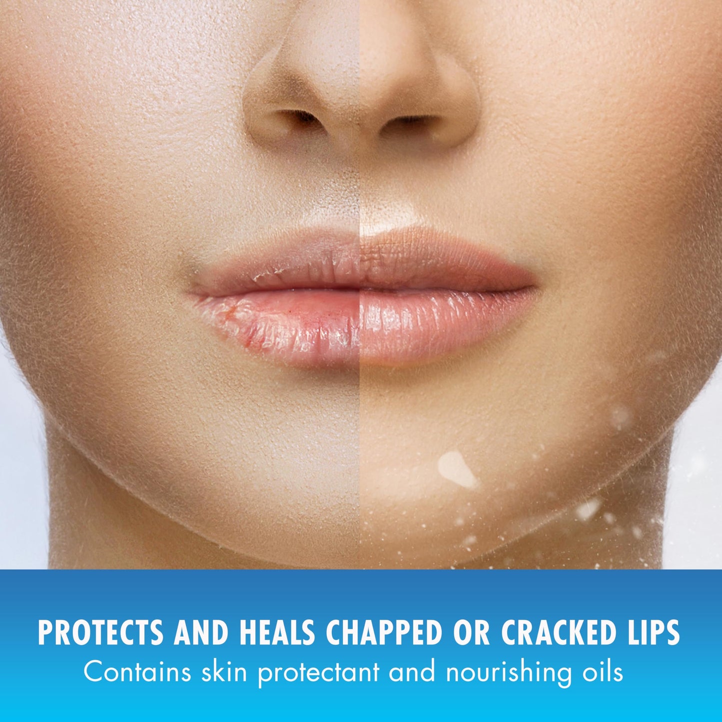 Natural Ice Original Medicated Lip Balm, Hydrating Lip Care for Dry, Chapped Lips, Moisturizing Formula with SPF 15 Helps Prevent Sunburn, Protection Beauty & Personal Care Natural Ice