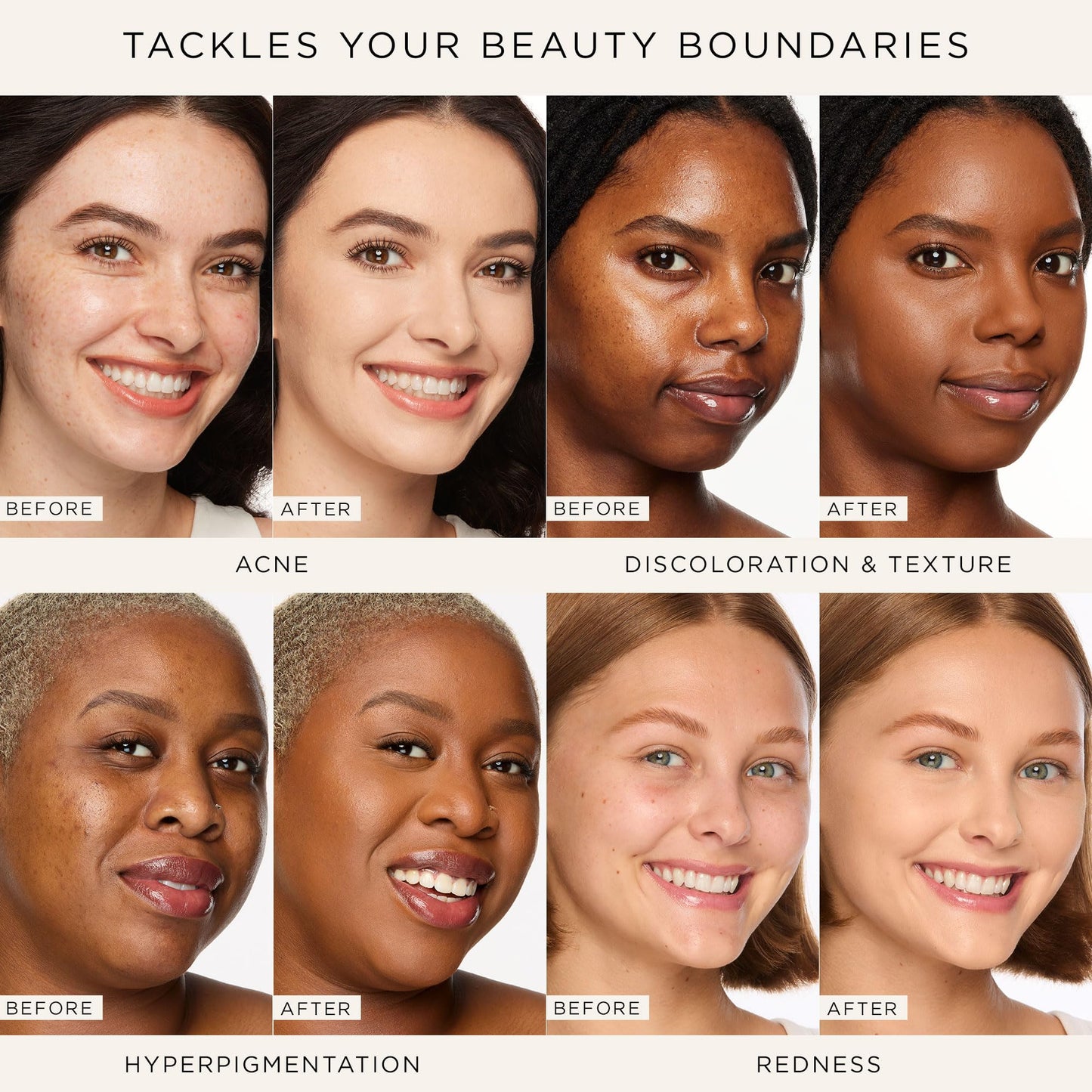 tarte shape tape concealer - Full Size-Coverage, Matte Finish for Under Eye, Dark Circles, Fine Lines, Redness & Discoloration, Longwear Beauty & Personal Care tarte