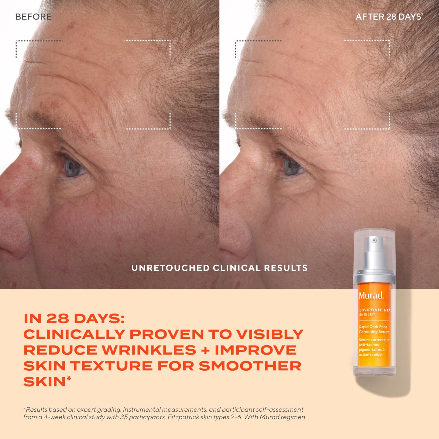 Murad Rapid Dark Spot Correcting Serum - Advanced Anti-Aging Formula with Patented Resorcinol Technology, Tranexamic and Glycolic Acids Beauty & Personal Care Murad