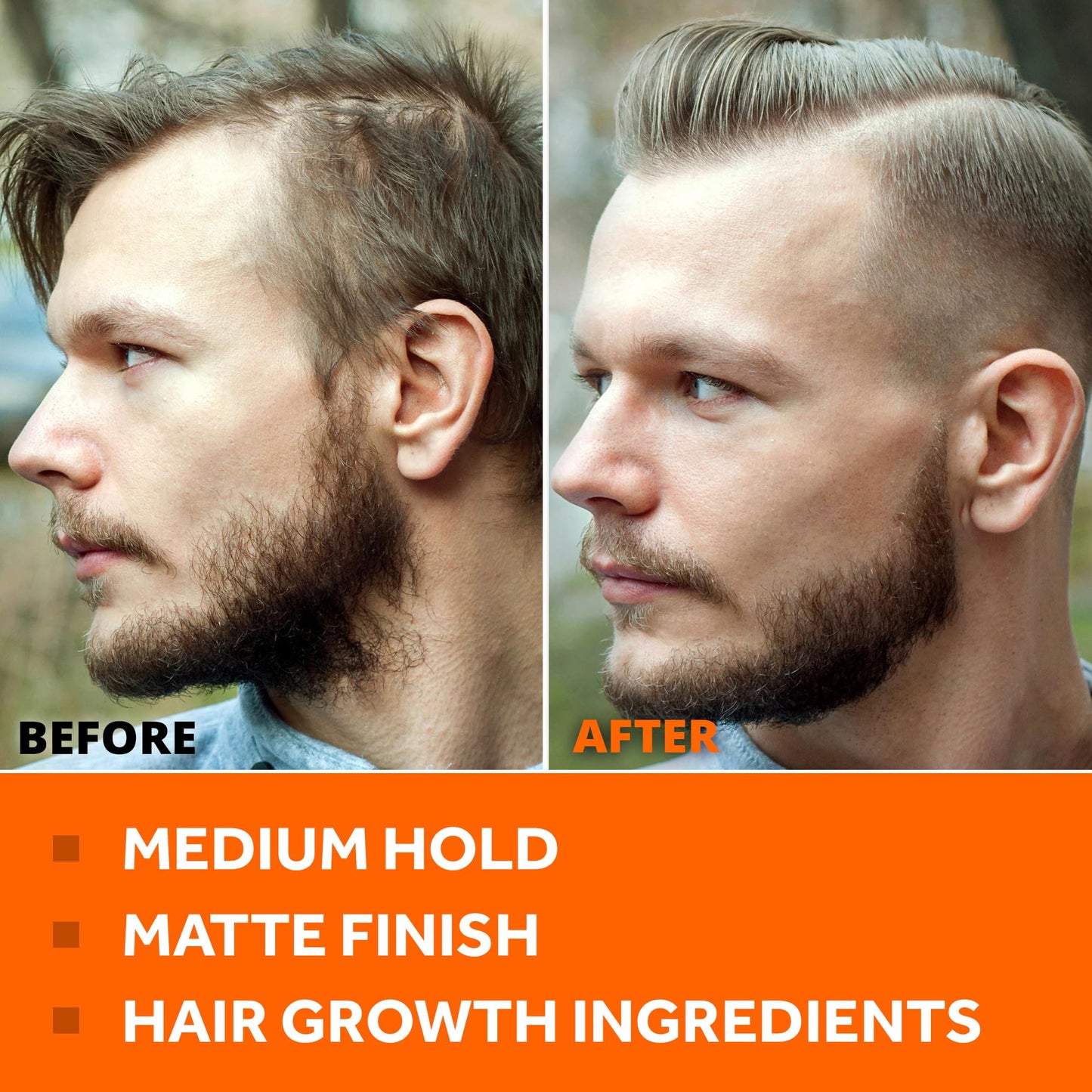 FOLLICLE BOOSTER Hair Growth Pomade - 1 Pack, Infused with Thinning Combating Ingredients, Water-based Cream Formulation, Ethically Sourced, Medium Beauty & Personal Care FOLLICLE BOOSTER