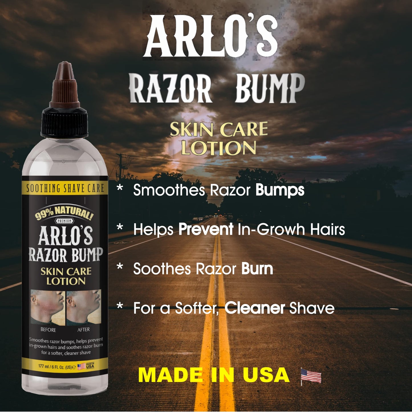 Arlo's Razor Bump Skin Care Lotion 6 oz. Beauty & Personal Care Arlo's