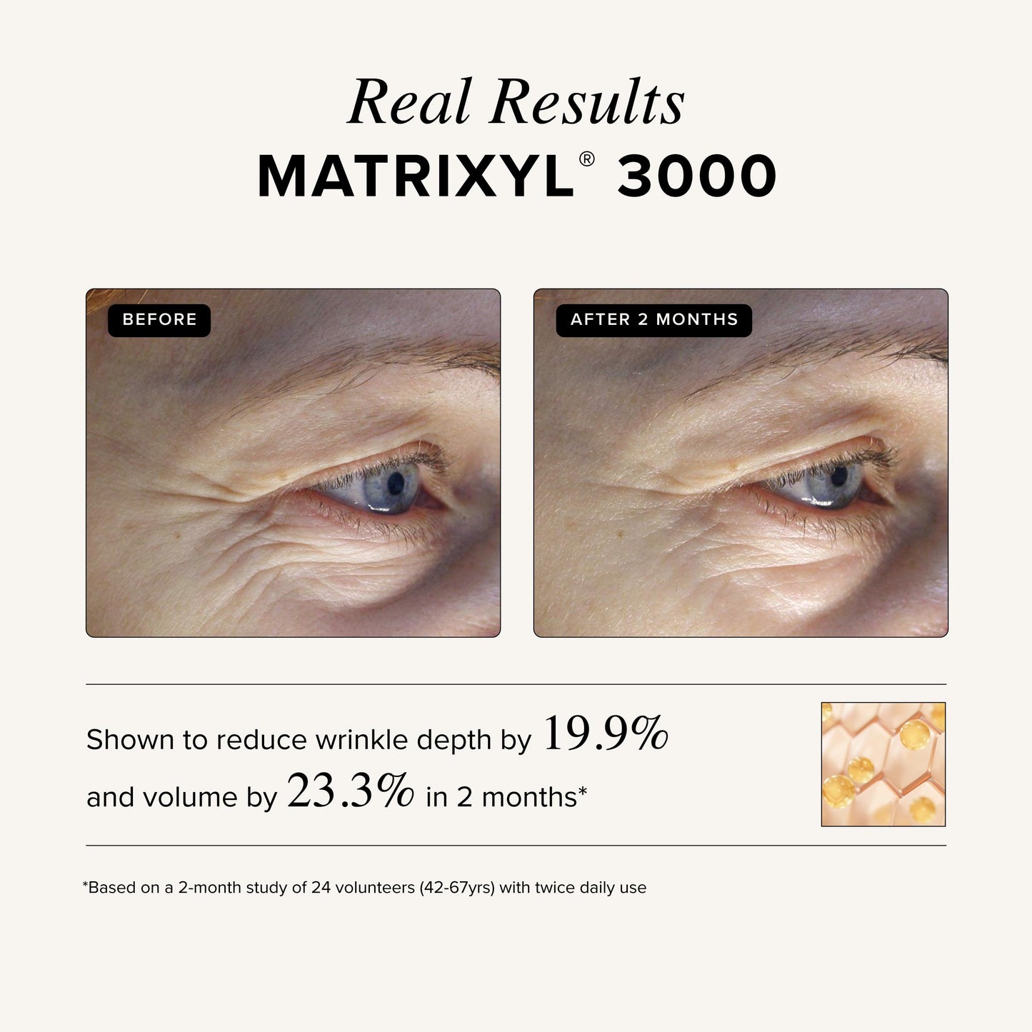 Asterwood Matrixyl 3000 + Argireline Serum with Hyaluronic Acid - Anti-Aging, Wrinkle Reducing, Collagen Boosting - Fragrance-Free - 2 Fl Oz Beauty & Personal Care Asterwood
