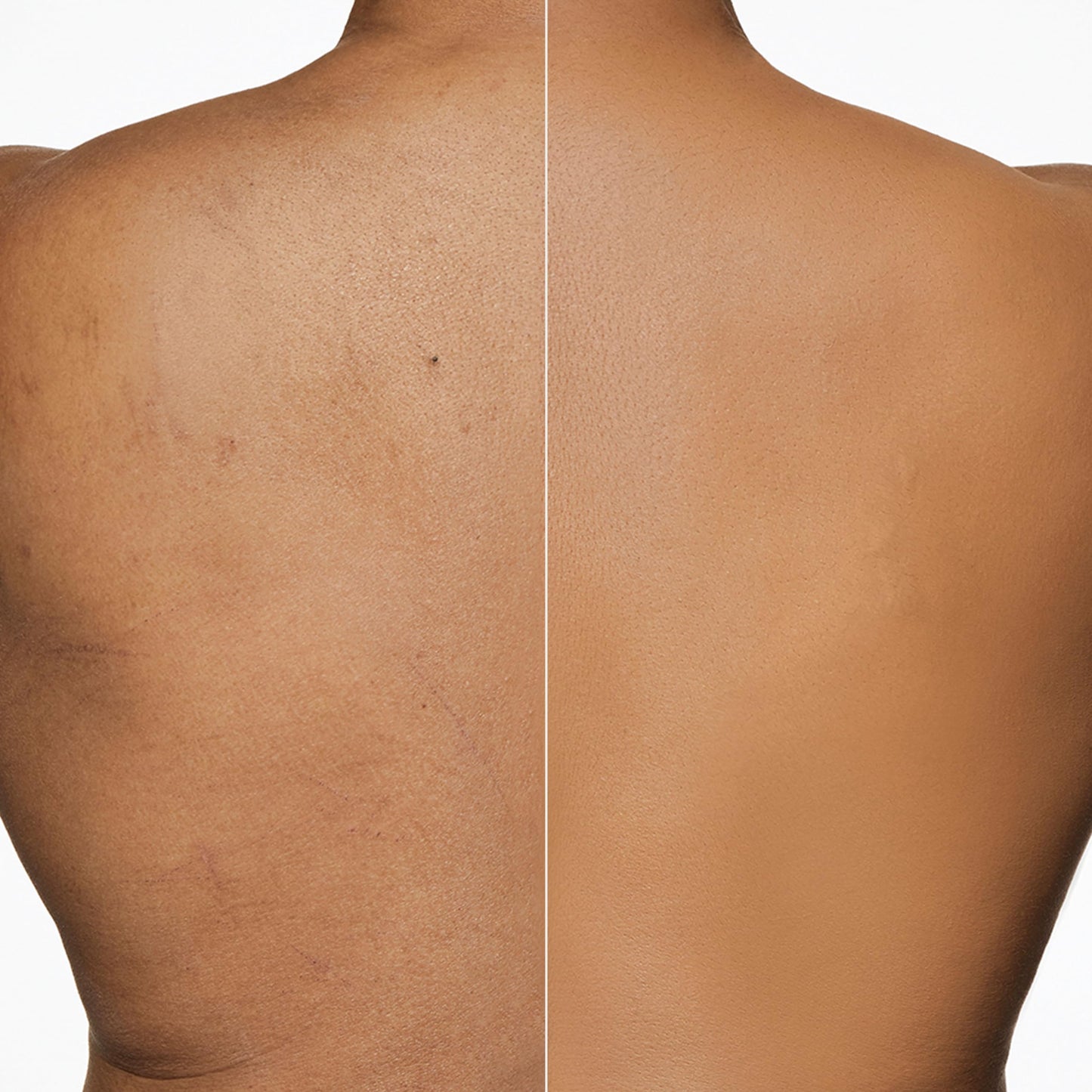 Dermablend Leg and Body Makeup Foundation Beauty & Personal Care Dermablend