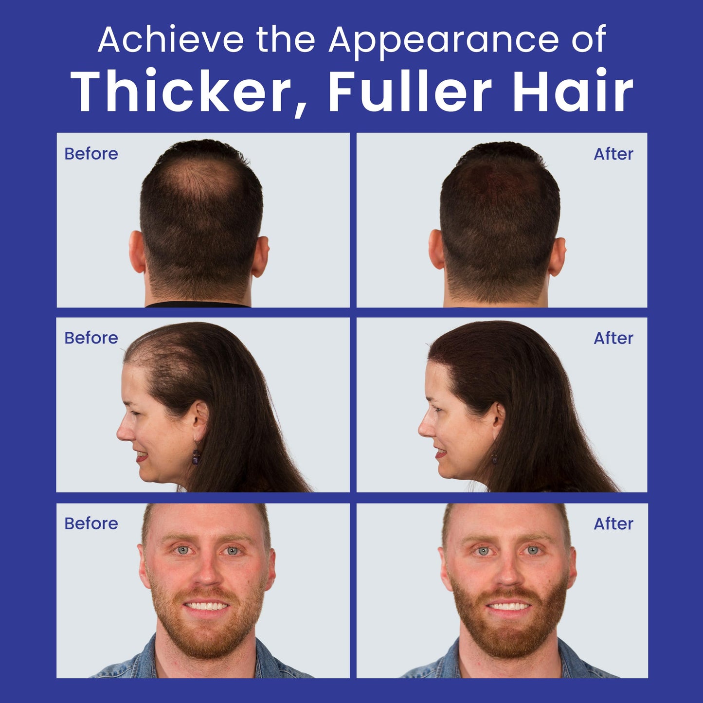 INFINITY Hair Fibers Medium Brown for Thinning Hair for Women & Men - 100% Undetectable Hair Building Fiber Powder - Conceal Hair Loss in 15 Seconds Beauty & Personal Care Infinity