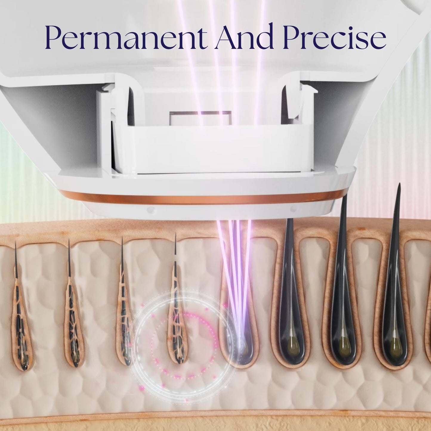 Epilaser At-Home True Laser Hair Removal Device for Light Skin, Safe, Intelligent, Painless and Permanent Hair Removal for Face, Body, Bikini Line Beauty and Personal Care Epilady