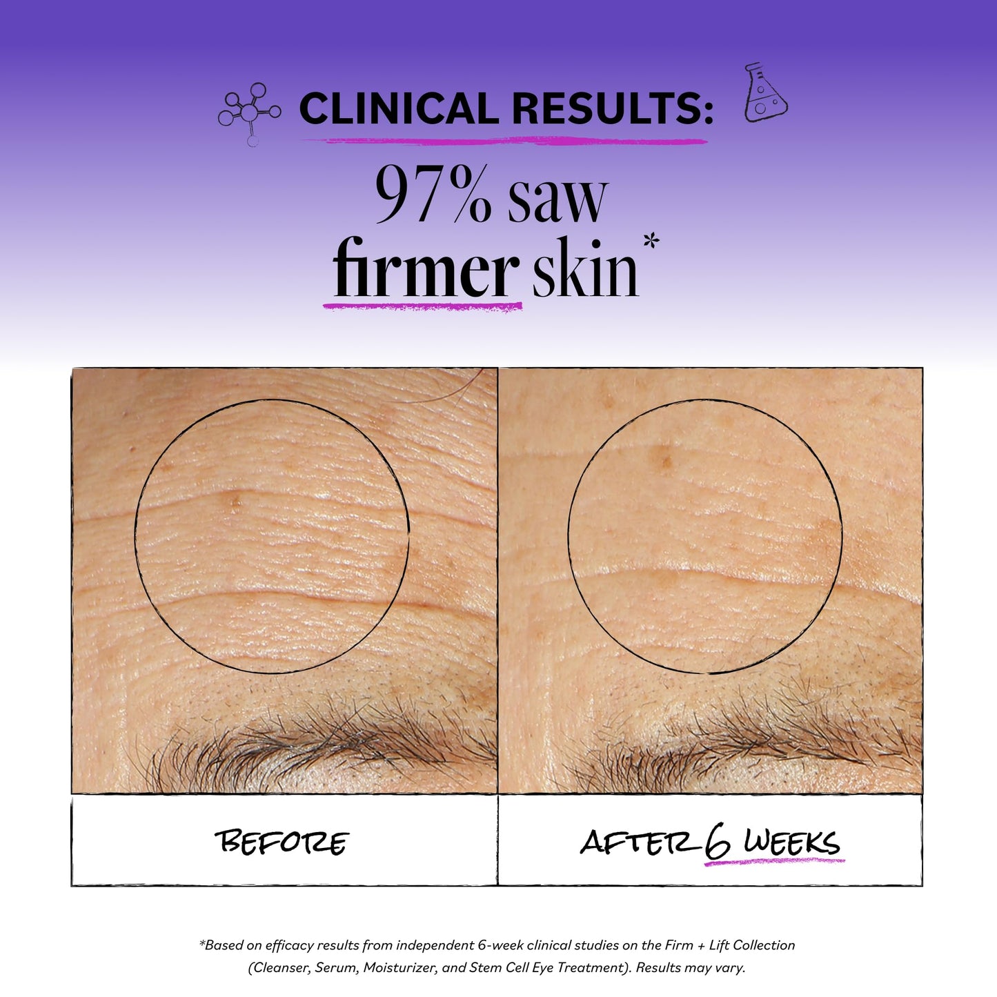 DERMA E Ultra Lift DMAE Concentrated Serum - All Natural Skin Firming Serum - Hydrating Serum with Copper Peptides and Resveratrol - Concentrated Beauty & Personal Care Derma E