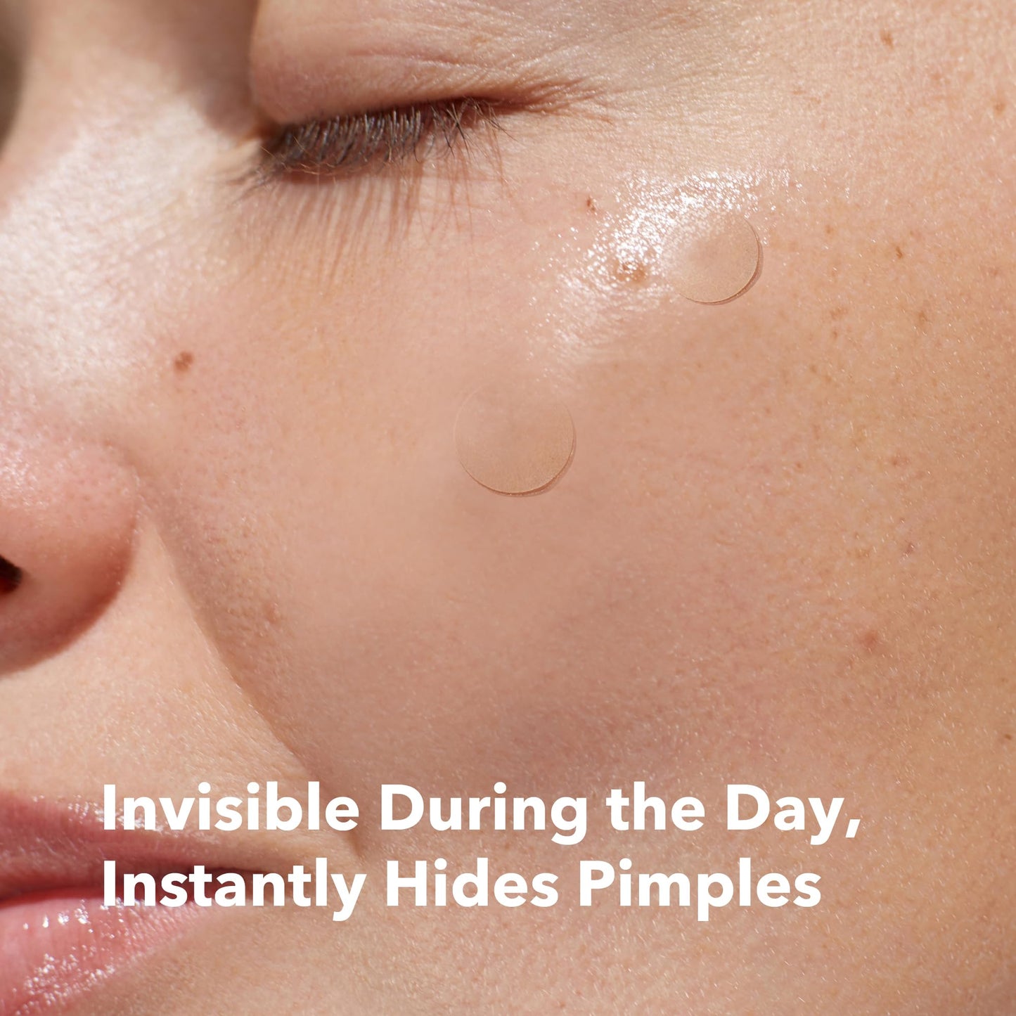 AVARELLE Invisible Acne Spot Patch (24 Count) Ultra Thin Hydrocolloid Spot Sticker for Day Time Acne l For Covering Zits & Blemish with Calendula Beauty & Personal Care AVARELLE