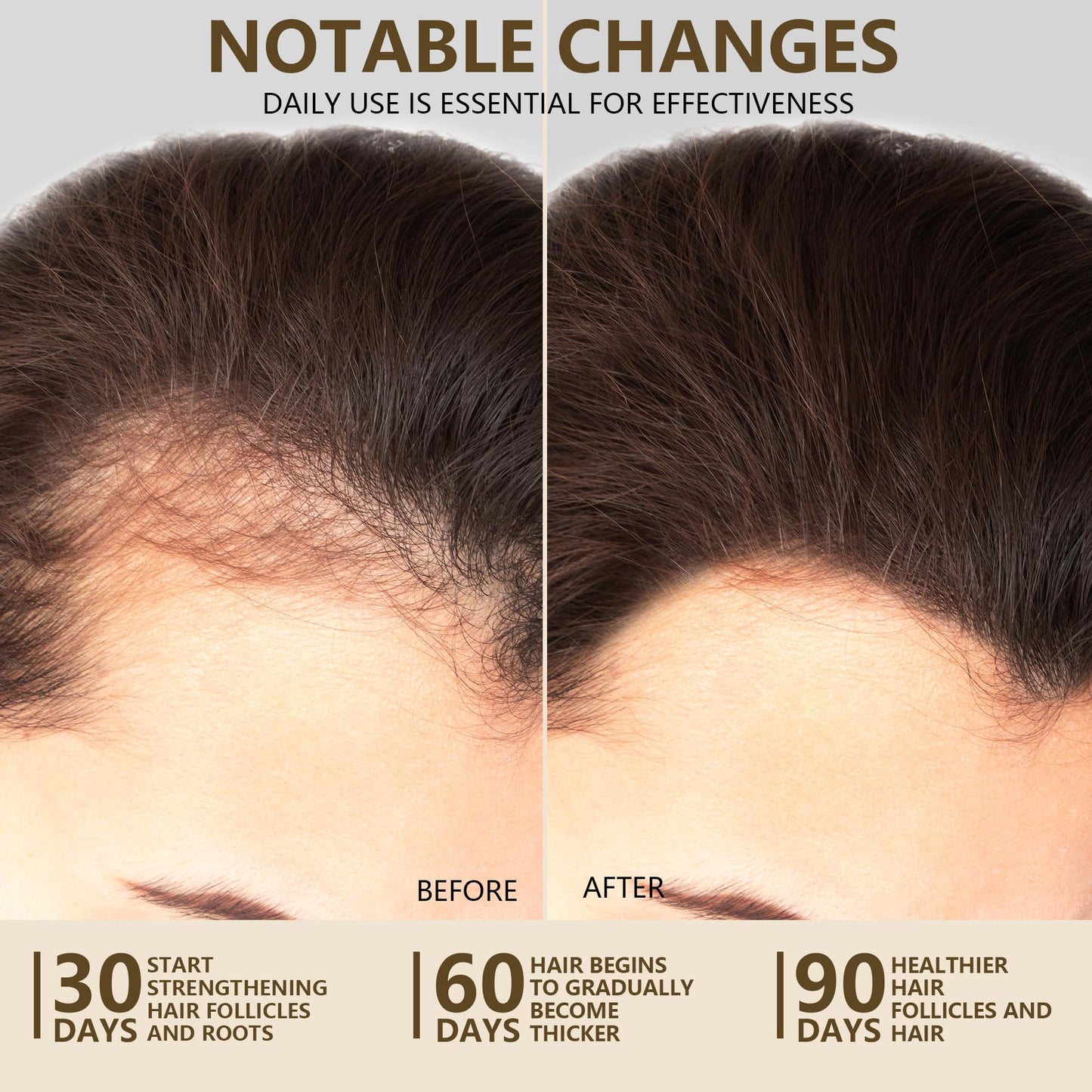 Ktintar 100% Natural Raw Batana Oil for Hair Growth, Unrefined & Organic Dr Sebi Hair Growth Oil From Honduras, Prevents Hair Loss, Eliminates Split Beauty & Personal Care Ktintar