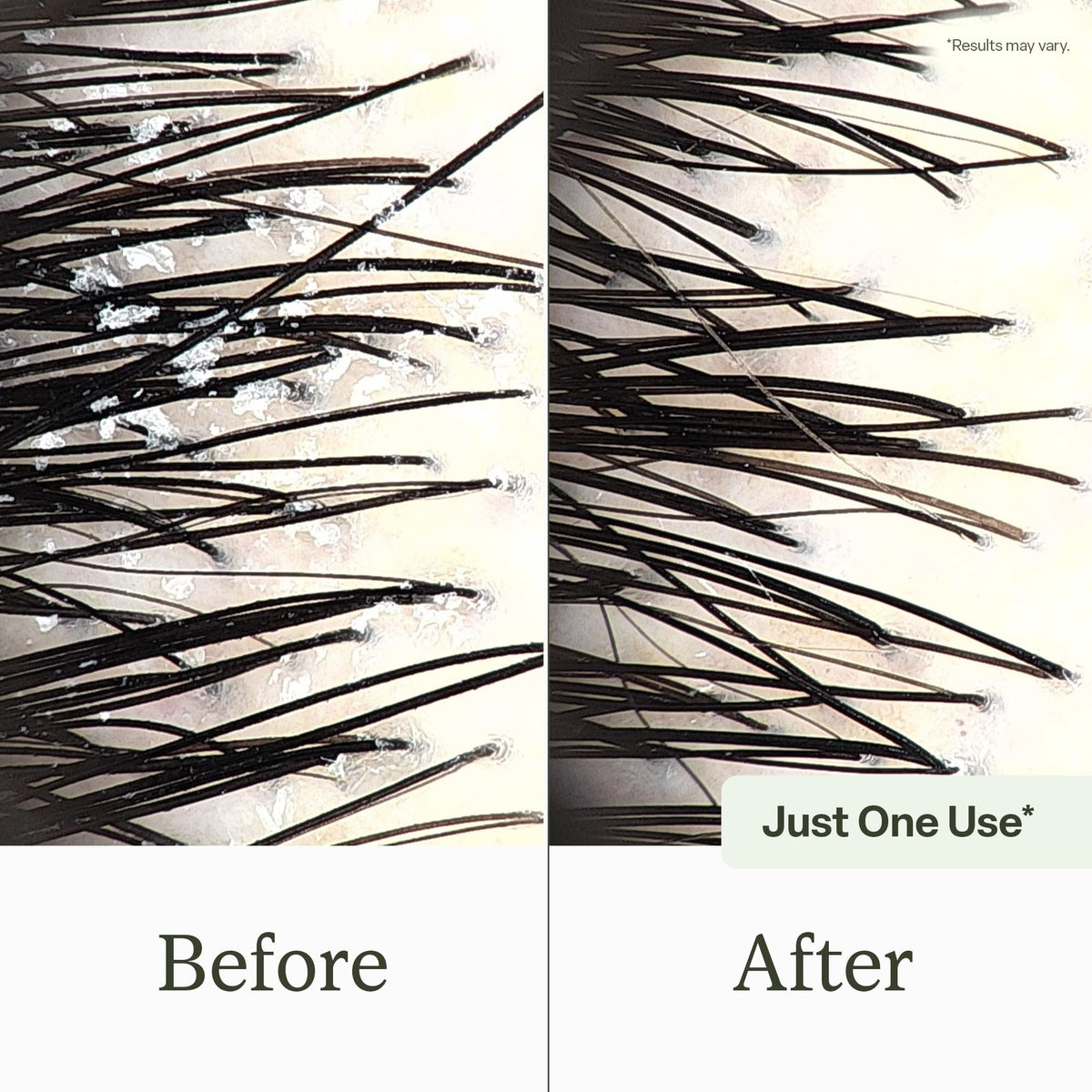 divi Scalp Reset Shampoo | Weekly Clarifying Treatment | 5 oz