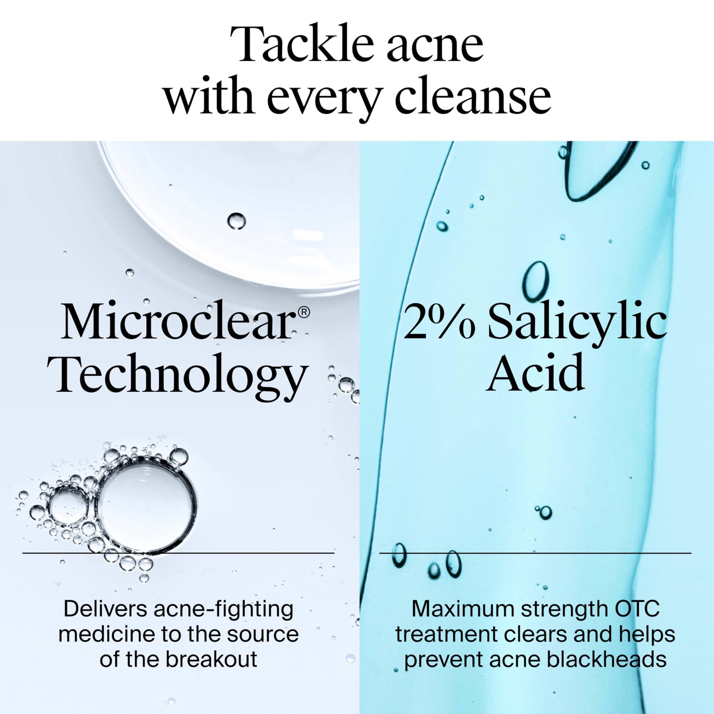 Neutrogena Oil-Free Acne Face Wash - Facial Cleanser with Salicylic Acid, Daily Cleanser for Oily & Acne-Prone Skin, Clears & Helps Prevent Breakouts Beauty & Personal Care Neutrogena