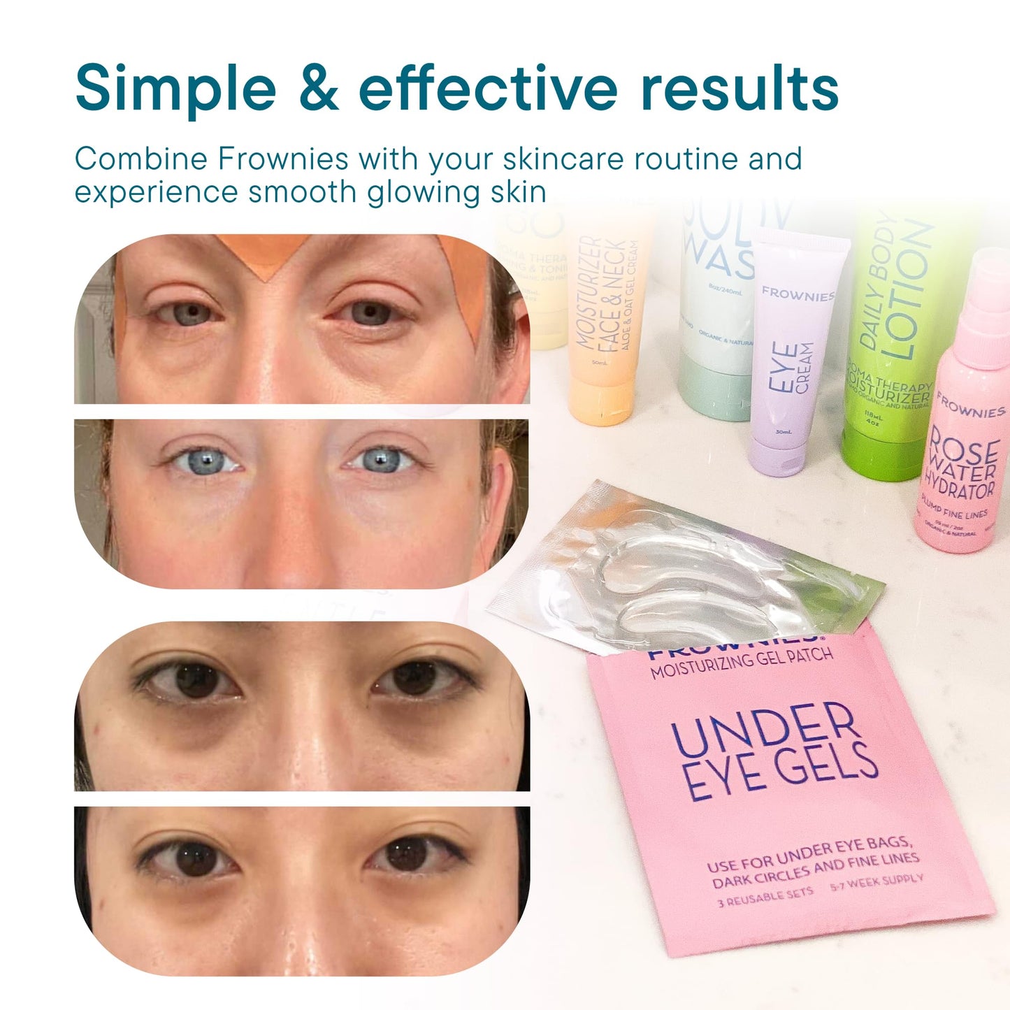 Frownies Under Eye Gel Patches for Puffy Eyes - Dark Circles with Cactus Collagen - Reusable, 3 Pack Beauty & Personal Care Frownies