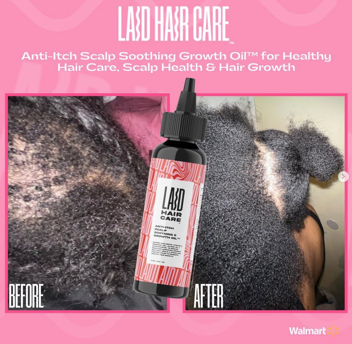 LAID HAIR CARE Anti-Itch Scalp Soothing Mega Growth Oil