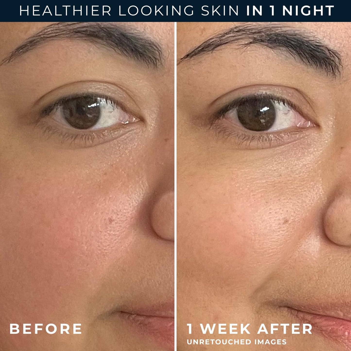 RoC Barrier Renew Night Moisturizer with Ceramides & Antioxidant Green Tea and Lipo Peptides to Renew Skin Barrier, (2.5 oz) with Retinol Eye Cream Beauty & Personal Care RoC
